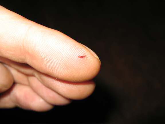 My finger after being assaulted by my hamster Lucy.