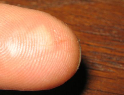 OUCH !!! ... Geeking It ... Can be Dangerous!